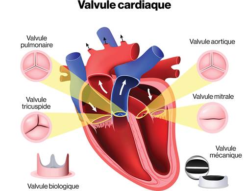 Valvulopathie | Fondation des maladies du cœur et de l'AVC