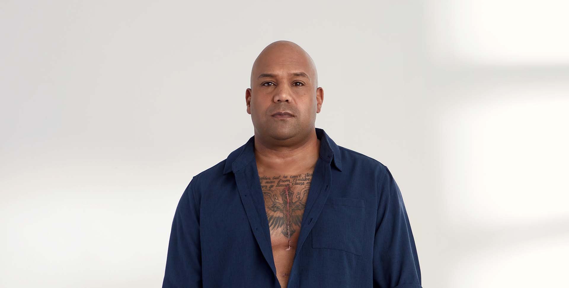Kevin Lobo, survivant d’une maladie du cœur, montre sur sa poitrine la cicatrice de l’incision.