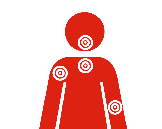 Douleur au haut du corps