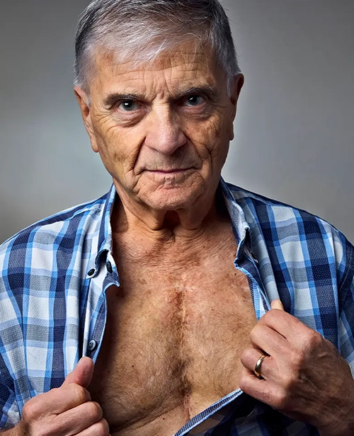 John Wheatcroft, qui vit avec une cardiopathie congénitale, montre la cicatrice sur sa poitrine.