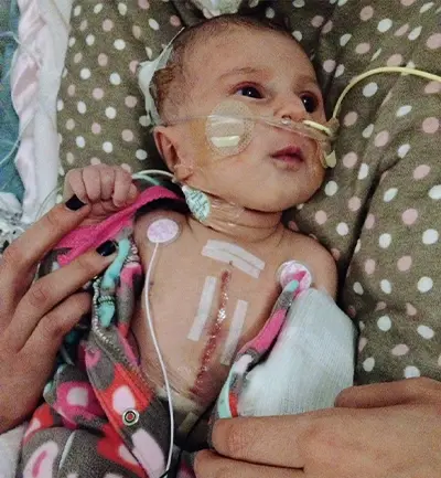 La fille de Nick Foligno, Milana, à l’hôpital avec sa cicatrice bien en vue.