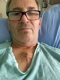 Paul King dans une chemise d’hôpital; il a une incision sur la poitrine à la suite d’une chirurgie à cœur ouvert. 